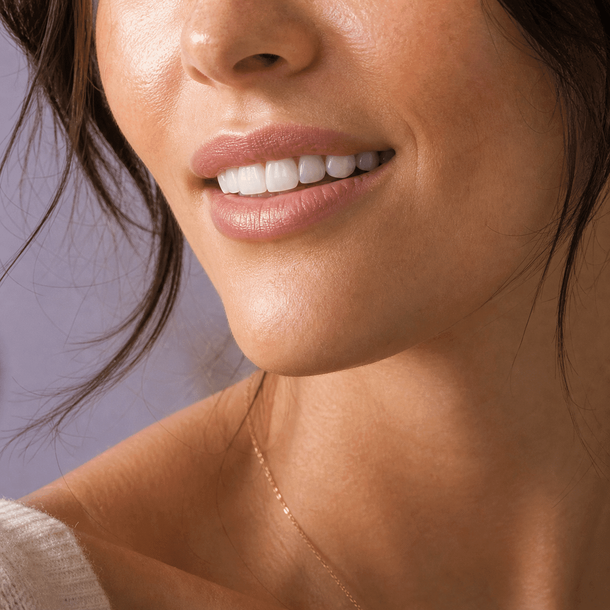 Refined editorial close-up of a transformed smile after porcelain veneers at A Dental Office in Barrie, Ontario