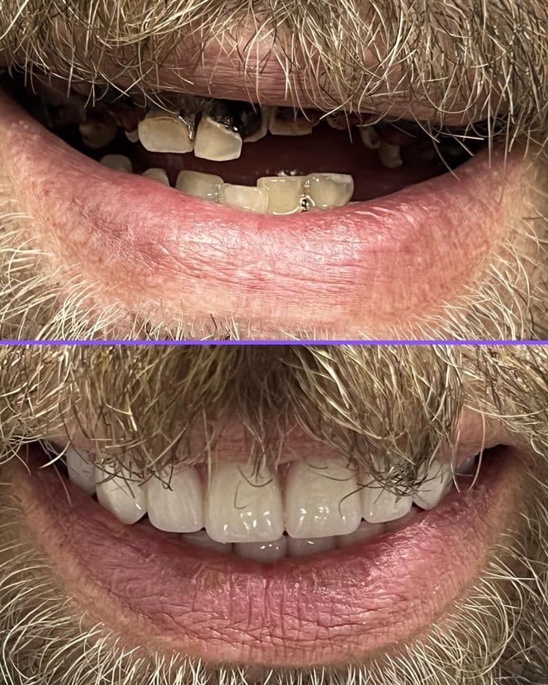 Case 1 before and after