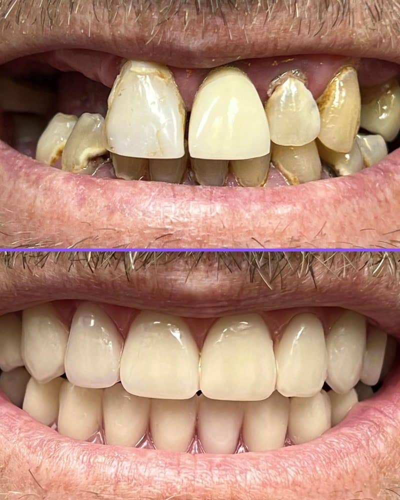 Case 2 before and after