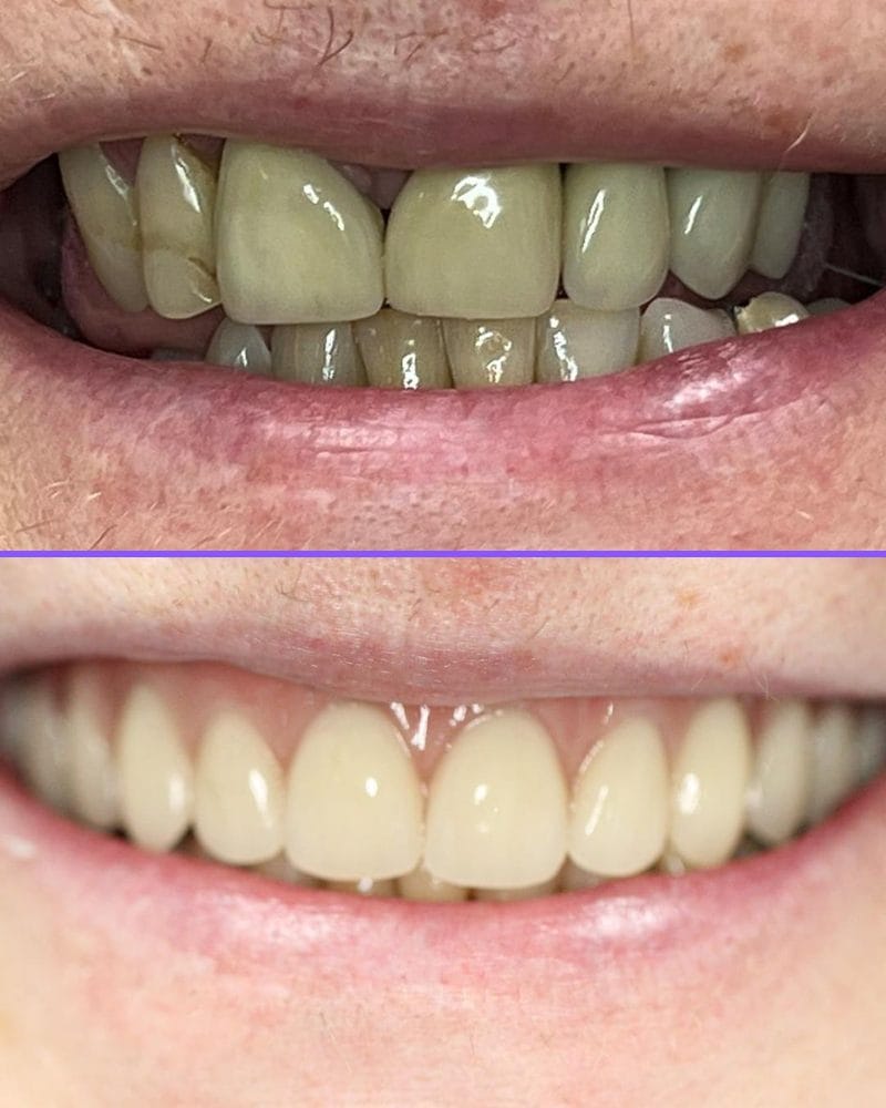 Case 3 before and after