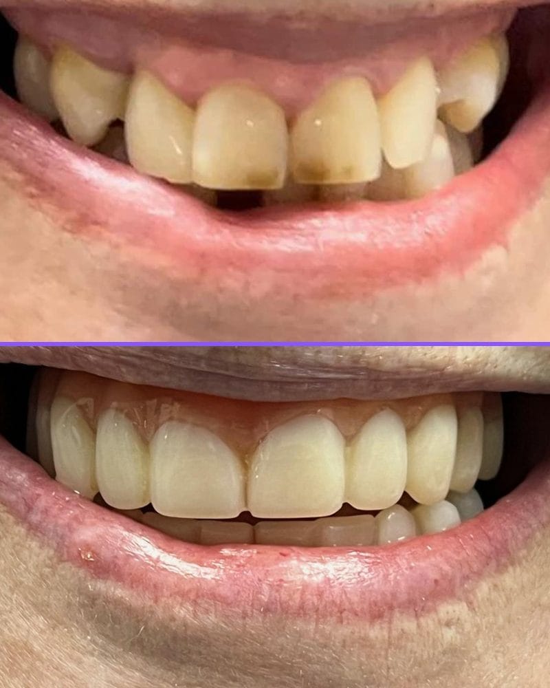 Case 4 before and after